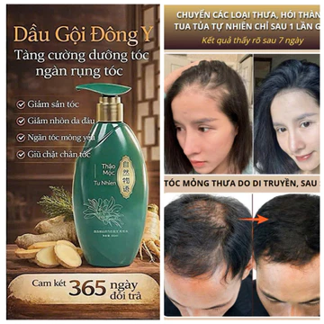Dầu Gội Dược Liệu Đông Y Giảm Rụng Tóc – Nhân Sâm Hà Thủ Ô Kích Mọc Tóc Nhanh, Dưỡng Tóc Dày Mượt, Phục Hồi Tóc Yếu