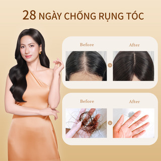Bộ Dầu Gội UILICY 300ml*2 Không Silicone, Làm Sạch Dịu Nhẹ, Giảm Dầu Da Đầu, Giảm Rụng Tóc, Kích Thích Mọc Tóc Nhanh