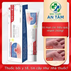 Hỗ trợ làm khô mụn thịt, mụn cóc với kem hỗ trợ làm mềm và phục hồi da-QY4