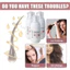 Bộ 4 Chai Xịt Dưỡng Da Đầu Zephta H-Regrow 2.0 Rice Nutri Spray Chứa Biotin & Caffeine Giảm Rụng Tóc, Kích Thích Mọc Tóc