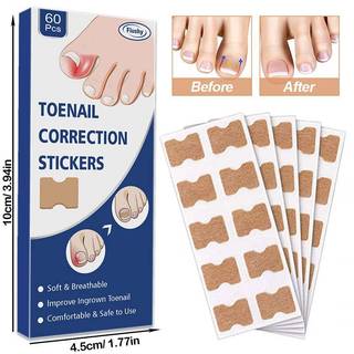 JRP 60 Chiếc Cây Phát Triển Móng Tay Chỉnh Sửa Móng Chân Chân Corrector Miếng Dán Paronychia Điều Trị Phục Hồi Corrector Dụng Cụ Chăm Sóc Móng Tay JRP