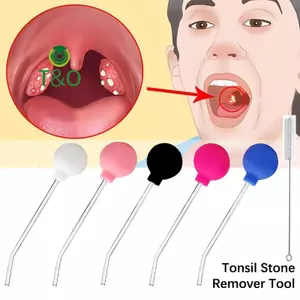 Dụng cụ tẩy đá Tonsil Dụng cụ làm sạch miệng Dụng cụ chăm sóc sáp tai Tonsil Đá bóng hút kiểu thủ công [mới]
