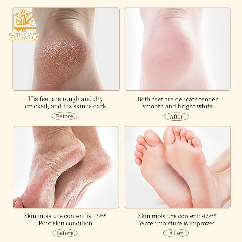 Kem Dưỡng Ẩm Alittlesetrtu Dưỡng Ẩm Kem Dưỡng Da Tay Chống Đóng Băng 60g VN
