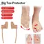 Có thể điều chỉnh Hallux Valgus Tay áo Spacer Separator Toe Corrector Vải Bunion Corrector Thể thao thoáng khí Bunion Sos Chạy bộ