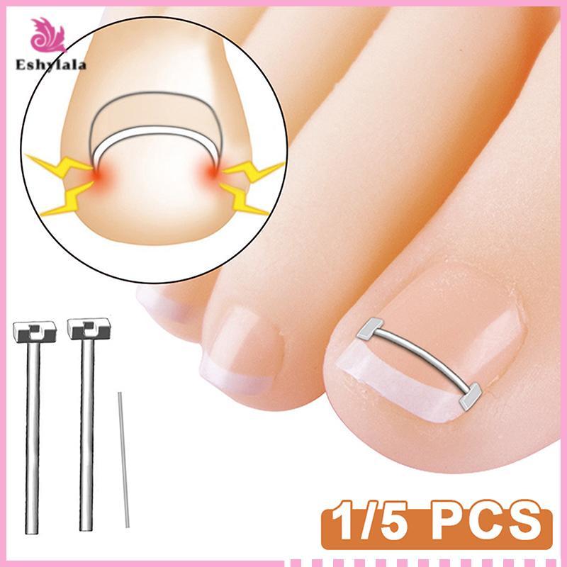 Dụng cụ chỉnh sửa móng chân mọc ngược Eshylala Kẹp làm thẳng phục hồi móng chân chuyên nghiệp [MỚI]