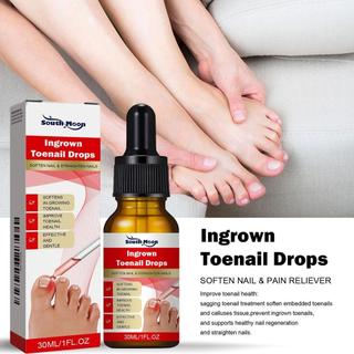 Máy làm mềm móng chân mọc ngược 30ML Thuốc giảm cảm giác khó chịu Dụng cụ chỉnh sửa móng chân mọc ngược cho vết bẩn màu vàng ewoekvn