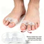 Đệm chân tách ngón chân Bunion Soft 3 lỗ cho Hallux Valgus & Bàn chân chồng chéo