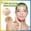 BVY 4cm * 50cm Silicone Tấm Loại Bỏ Dải Gel Silicon Sẹo Dải Cho Phẫu Thuật Keloid Đốt Sẹo Miếng Dán.