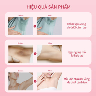 Tinh Chất Lăn Khử Mùi UILICY 30ml - Khử Mùi Hiệu Quả Ngăn Mồ Hôi Khô Thoáng 24H Giảm Xỉn Màu Tiện Lợi Nhiều Mùi Hương