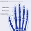 AA Ngón Tay Ngón Chân Hỗ Trợ Dây Đeo Có Thể Điều Chỉnh Giảm Đau Sửa Nẹp Thẳng Nẹp Corrector Hỗ Trợ Di Chuyển Gãy VN