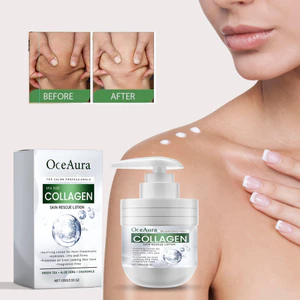 OceAura Collagen Skin Rescue Lotion 100g - Sữa dưỡng dịu sau điều trị với lô hội & trà xanh