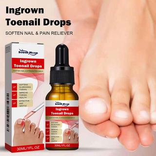 Máy làm mềm móng chân mọc ngược 30ML Thuốc giảm cảm giác khó chịu Dụng cụ chỉnh sửa móng chân mọc ngược cho vết bẩn màu vàng ewoekvn