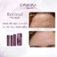 Kem dưỡng Casmara Retinol Proage Renewal Night Cream 0.15%