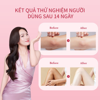 Bộ Lăn Khử Mùi Và Tinh Chất Cơ Thể UILICY 30ml+200ml Ngăn Mồ Hôi Vùng Nách, Khử Mùi, Dưỡng Trắng, Hương Thơm Tự Nhiên