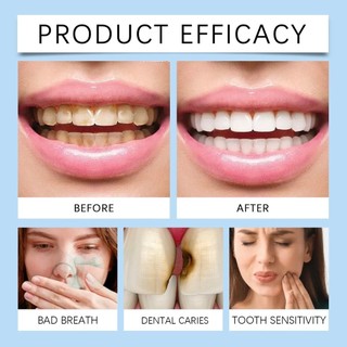 Serum chăm sóc răng miệng cao cấp, Làm trắng và tăng cường men răng, Đánh Bay Sâu Răng, Ê Buốt Răng, Răng Chắc