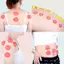 12 Chiếc Bình Massage Silicon Bộ Cốc Trị Liệu Trung Quốc Máy Mát Xa Toàn Thân Chống Cellulite Hút Chân Không Lon Mới