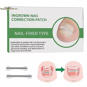 TRTR 1 Cái Chỉnh Móng Tay Stiers Ingrown Móng Chân Corrector Miếng Dán Vô Hình Cường Độ Cao Phụ Trợ Miếng Dán Paronychia Điều Trị Phục Hồi Corrector Chăm Sóc Bàn Chân VN