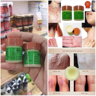 Kem Bôi Nấm Chàm Ngứa Ngoài Da 29A Thái Lan