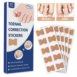 JRP 60 Chiếc Cây Phát Triển Móng Tay Chỉnh Sửa Móng Chân Chân Corrector Miếng Dán Paronychia Điều Trị Phục Hồi Corrector Dụng Cụ Chăm Sóc Móng Tay JRP