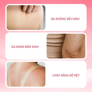 Bộ Lăn Khử Mùi Và Tinh Chất Chống Nắng UILICY 30ml+200ml Ngăn Mồ Hôi, Giữ Khô Thoáng, Nâng Tông Tức Thì, Bảo Vệ Da