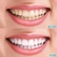 Bộ bàn chải đánh răng du lịch di động - Bàn chải đánh răng hạt nổ dùng một lần có bóng - Bàn chải đánh răng du lịch di động - Không cần rửa - Chăm sóc răng miệng du lịch / Giao hàng miễn phí