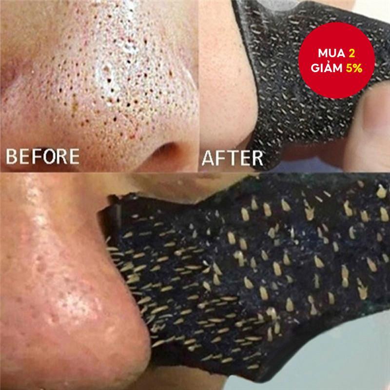 10 Chiếc Sâu Làm Sạch Mũi Dán Than Tre Mụn Đầu Đen Mũi Chấm Chấm Dải Dụng Cụ Chăm Sóc Da Chống Mụn