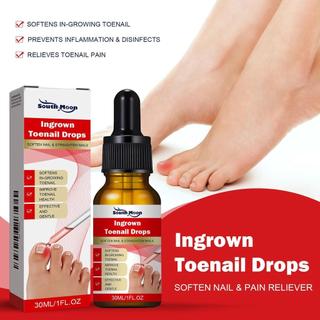 Máy làm mềm móng chân mọc ngược 30ML Thuốc giảm cảm giác khó chịu Dụng cụ chỉnh sửa móng chân mọc ngược cho vết bẩn màu vàng ewoekvn