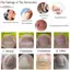 TRTR 1 Cái Chỉnh Móng Tay Stiers Ingrown Móng Chân Corrector Miếng Dán Vô Hình Cường Độ Cao Phụ Trợ Miếng Dán Paronychia Điều Trị Phục Hồi Corrector Chăm Sóc Bàn Chân VN
