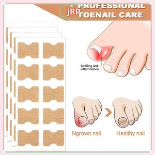 JRP 60 Chiếc Cây Phát Triển Móng Tay Chỉnh Sửa Móng Chân Chân Corrector Miếng Dán Paronychia Điều Trị Phục Hồi Corrector Dụng Cụ Chăm Sóc Móng Tay JRP