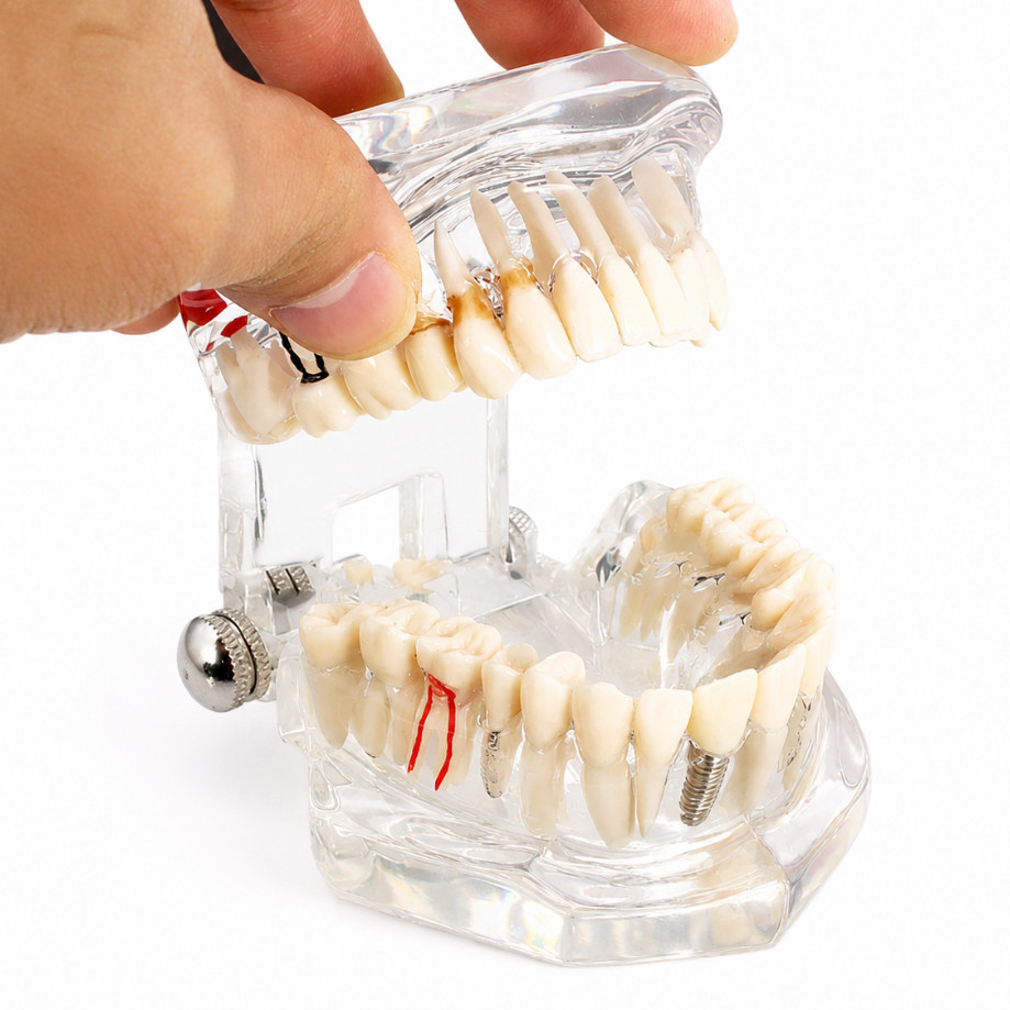 YLDENT Mẫu hàm tư vấn bệnh lý - Mẫu hàm tư vấn 8in1  (Có Xuất VAT)