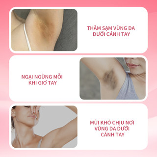 Bộ Dầu Gội Và Kem Nách UILICY 300ml+30g Không Silicone, Kiềm Dầu, Mọc Tóc, Làm Sáng Vùng Nách, Giảm Thâm Sạm Đều Màu Da