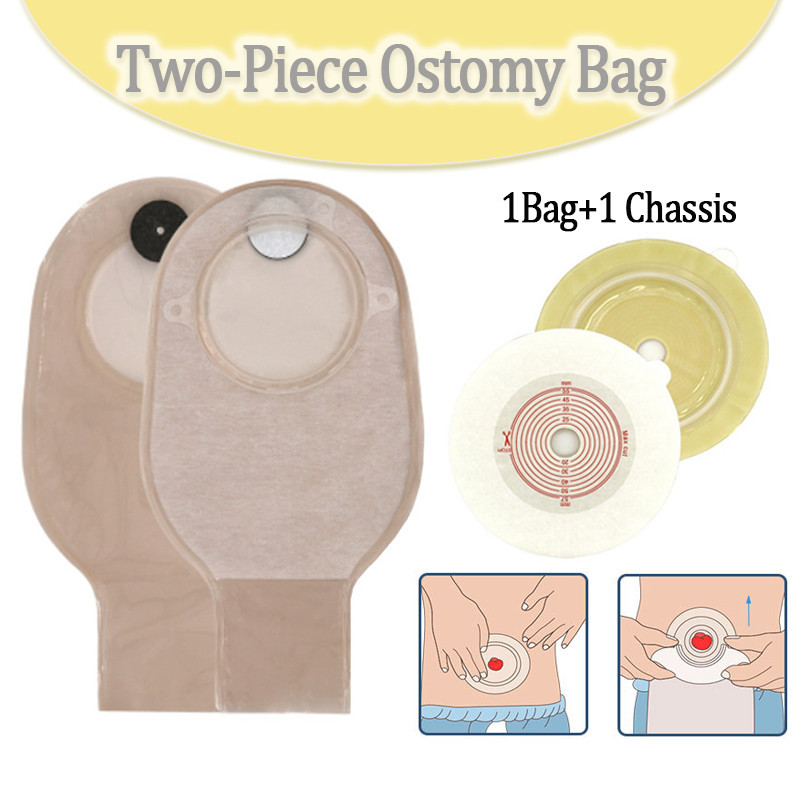 Túi Anorectal dùng một lần Túi Stoma Loại mở Than hoạt tính Loại bỏ mùi Túi phân chăm sóc hai mảnh