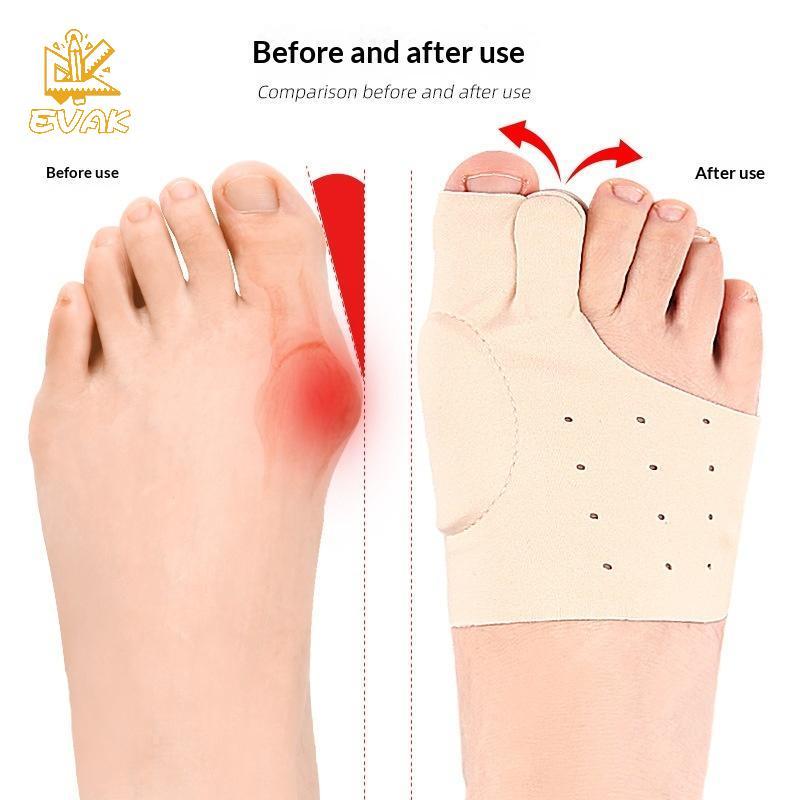 Alittlesetrtu 1 Cặp Dụng Cụ Tách Ngón Chân Corrector Hallux Valgus Bunion Thẳng Giảm Đau Điều Chỉnh Ngón Tay Cái Dụng Cụ Làm Móng Duỗi Chăm Sóc Bàn Chân VN