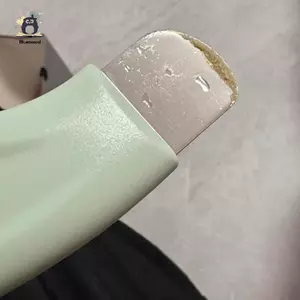 Máy chà sàn da mặt Loại bỏ mụn đầu có nắp mặt Thìa tẩy tế bào chết Làm sạch sâu Dụng cụ chăm sóc da Mới