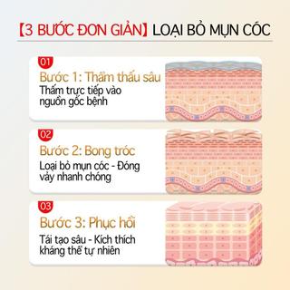 Kem bôi loại bỏ mụn thịt, mụn nhỏ ở cổ, mụn cóc, nách – Dưỡng da làm đẹp, làm sáng da, mịn da, tái tạo da hiệu quả.