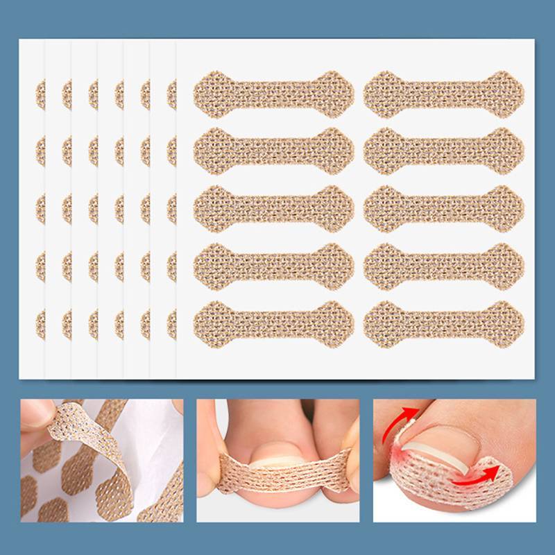 HFSHY 4 / 10 Tờ Dụng cụ làm móng chân mọc ngược Móng chân cho thợ sửa móng tay Paronychia Điều trị Fixer Phục hồi chăm sóc bàn chân Bunion VN