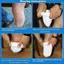 HFSHY Thiêned Gel Y Tế Giả Như vậy Thoáng Khí Co Giãn Hút Mồ Hôi Mềm Stump Bảo Vệ Amputee Tay Bắp Chống Mài Mòn VN