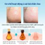 SET 3 MÓN_ Ủ mụn đầu đen, sợi bã nhờn Super Melting Sebum Softener + thanh đẩy mụn tặng kèm bông