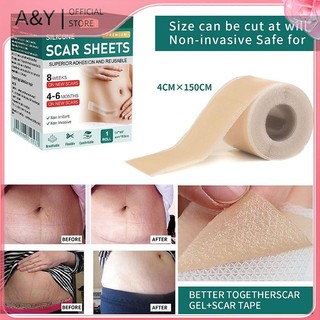 Miếng dán sẹo silicon A & Y 1 cuộn Miếng dán sẹo Gel 4cmX150cm Băng che sẹo tự dính Dải chăm sóc da có thể tái sử dụng và hiệu quả.