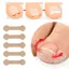 Trong kho 10 tấm mọc ngược móng chân Corrector Stickers cho paronychia bunion móng chân chăm sóc bàn chân cá tuyết