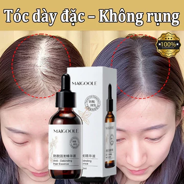 Tinh dầu mọc tóc serum mọc tóc tinh dầu kích thích mọc tóc nhanh dài chống rụng tóc kích mọc tóc giảm rụng tóc