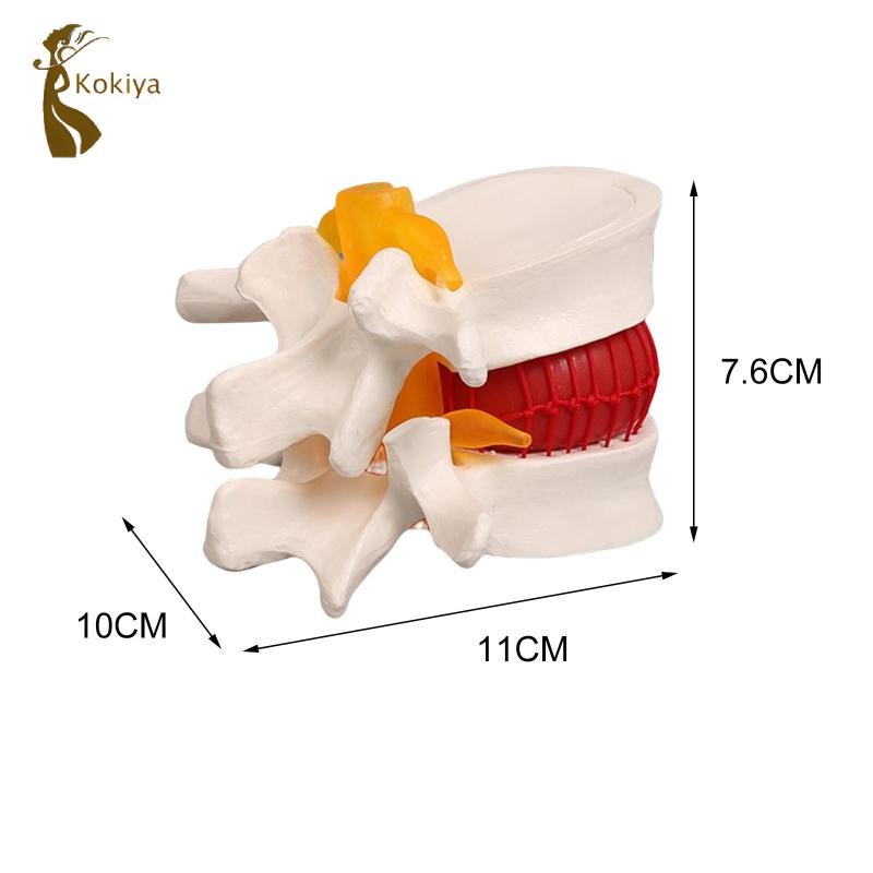 Mô hình thoát vị đĩa Mô hình cột sống 1: 1 để giảng dạy Hiển thị học tập