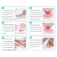 【48h】Combo 10 túi ostomy cao cấp, thiết kế chống tràn, có van thoát nước tiện lợi, giúp người bệnh thoải mái vận động.