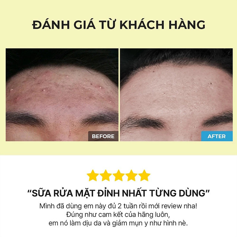 COSRX Skincare Set – Bộ Sản Phẩm Làm Sạch Và Dưỡng Ẩm Cho Da, Dễ Sử Dụng Hằng Ngày