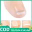 Trong kho mọc ngược móng chân Corrector công cụ chuyên nghiệp phục hồi móng chân thẳng Clip cá tuyết