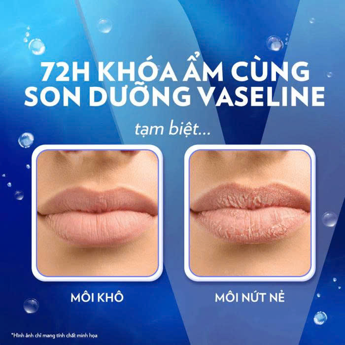 SON DƯỠNG MÔI VASELINE LIP THERAPY 7G
