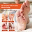 Kem Bôi Đánh Bay Mụn Cóc, Mụn Thịt Nấm Ngứa Chân Tay