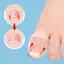 Trong Kho Silicone Mọc Trong Móng Chân Chỉnh Sửa Clip Vô Hình Đàn Hồi Móng Chân Nẹp Công Cụ Cá Tuyết