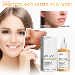 Nước Hoa Hồng 100ml Chăm Sóc Da, Loại Mụn Trứng Cá Nâng Cơ Săn Chắc Giảm Nếp Nhăn Làm Trắng Dưỡng Ẩm Da Kiểm Soát Dầu