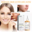Nước Hoa Hồng 100ml Chăm Sóc Da, Loại Mụn Trứng Cá Nâng Cơ Săn Chắc Giảm Nếp Nhăn Làm Trắng Dưỡng Ẩm Da Kiểm Soát Dầu